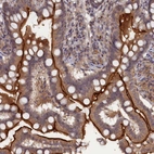 Immunohistochemical staining of human small intestine shows strong membranous positivity in glandular cells.