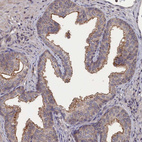 Immunohistochemical staining of human prostate shows moderate membranous positivity in glandular cells.