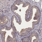 Immunohistochemical staining of human prostate shows moderate membranous positivity in glandular cells.