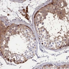 Immunohistochemical staining of human testis shows moderate membranous positivity in cells in seminiferous ducts.
