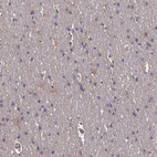 Immunohistochemical staining of human cerebral cortex shows no positivity in neurons as expected.
