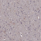 Immunohistochemical staining of human cerebral cortex shows no positivity in neurons as expected.
