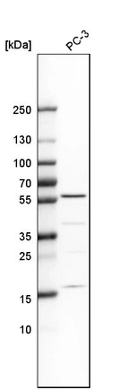 Anti-IP6K1 Antibody