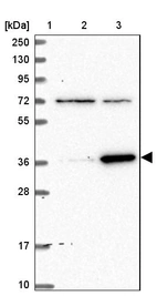Lane 1: Marker [kDa] 250, 130, 95, 72, 55, 36, 28, 17, 10_br/_Lane 2: Human cell line RT-4_br/_Lane 3: Human cell line U-251MG sp