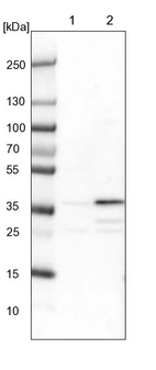 Lane 1: NIH-3T3 cell lysate (Mouse embryonic fibroblast cells)_br/_Lane 2: NBT-II cell lysate (Rat Wistar bladder tumour cells)
