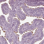 Immunohistochemical staining of human fallopian tube shows high expression.