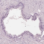 Immunohistochemical staining of human prostate shows low expression as expected.