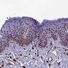 Immunohistochemical staining of human skin shows strong nuclear positivity in squamous epithelial cells.