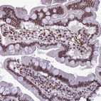 Immunohistochemical staining of human small intestine shows strong nuclear positivity in glandular cells.