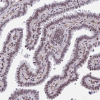 Immunohistochemical staining of human fallopian tube shows moderate nuclear positivity in glandular cells.