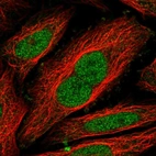 Immunofluorescent staining of human cell line SiHa shows localization to nucleoplasm.