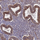 Immunohistochemical staining of human endometrium shows strong cytoplasmic positivity in glandular cells.