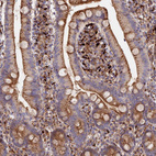 Immunohistochemical staining of human duodenum shows moderate to strong cytoplasmic positivity in glandular cells.