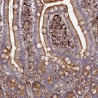 Immunohistochemical staining of human duodenum shows moderate to strong cytoplasmic positivity in glandular cells.
