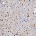 Immunohistochemical staining of human skeletal muscle shows weak cytoplasmic positivity in myocytes.