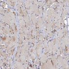 Immunohistochemical staining of human skeletal muscle shows weak cytoplasmic positivity in myocytes.