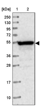 Lane 1: Marker [kDa] 250, 130, 95, 72, 55, 36, 28, 17, 10_br/_Lane 2: Human cell line RT-4