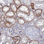 Immunohistochemical staining of human kidney shows strong membranous positivity in cells in tubules.
