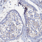 Immunohistochemical staining of human testis shows weak membranous positivity in cells in seminiferous ducts.