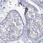 Immunohistochemical staining of human testis shows weak membranous positivity in cells in seminiferous ducts.