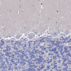 Immunohistochemical staining of human cerebellum shows no positivity in Purkinje cells as expected.