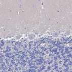 Immunohistochemical staining of human cerebellum shows no positivity in Purkinje cells as expected.