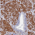 Immunohistochemical staining of human prostate shows moderate cytoplasmic positivity in smooth muscle cells.