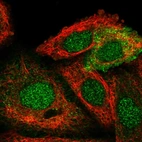 Immunofluorescent staining of human cell line A549 shows localization to nucleus & cytosol.