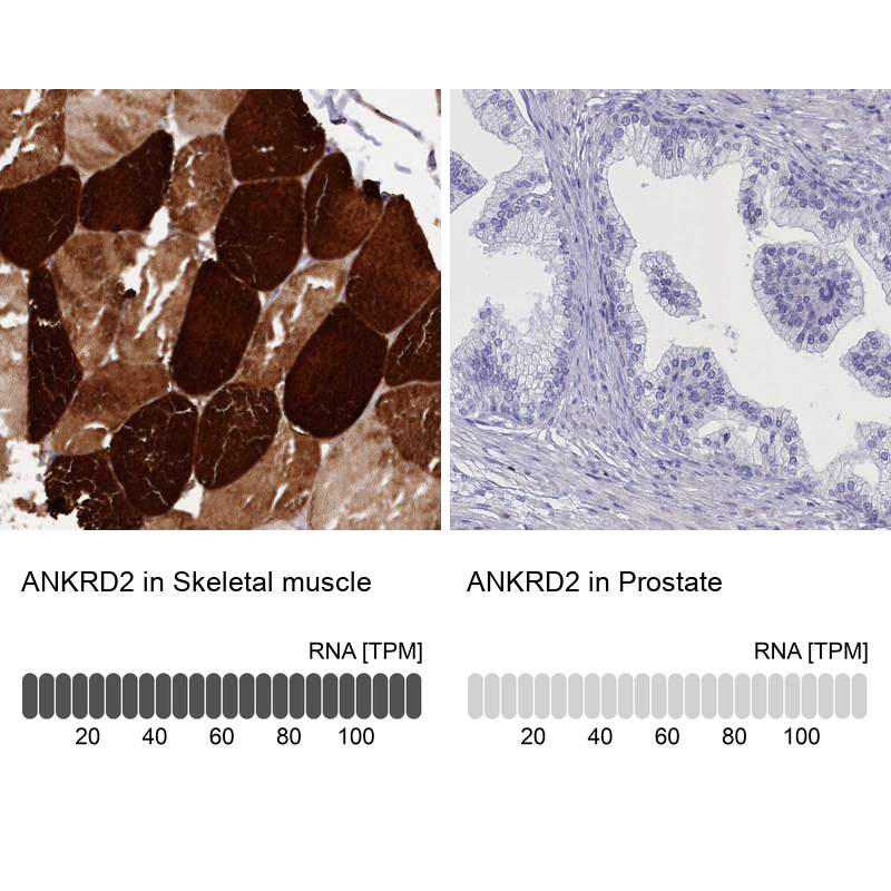 Anti-ANKRD2 Antibody