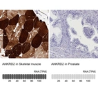 Anti-ANKRD2 Antibody