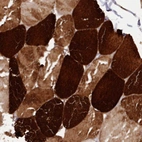 Immunohistochemical staining of human skeletal muscle shows high expression.