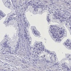 Immunohistochemical staining of human prostate shows low expression as expected.