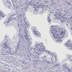 Immunohistochemical staining of human prostate shows low expression as expected.