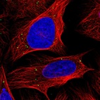 Immunofluorescent staining of human cell line U-2 OS shows localization to vesicles.