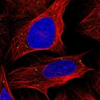 Immunofluorescent staining of human cell line U-2 OS shows localization to vesicles.
