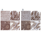 Anti-ZC3H18 Antibody