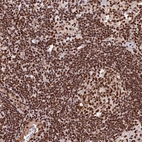 Immunohistochemical staining of human lymph node shows strong nuclear positivity in non-germinal center cells.