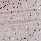 Immunohistochemical staining of human cerebral cortex shows strong nuclear positivity in neurons.
