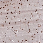 Immunohistochemical staining of human cerebral cortex shows strong nuclear positivity in neurons.