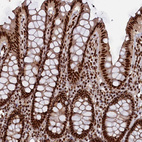 Immunohistochemical staining of human colon shows strong nuclear positivity in glandular cells.
