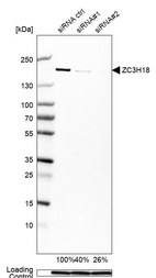 Western blot analysis in MCF-7 cells transfected with control siRNA, target specific siRNA probe #1 and #2, using Anti-ZC3H18 antibody. Remaining relative intensity is presented. Loading control: Anti-GAPDH.