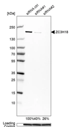 Western blot analysis in MCF-7 cells transfected with control siRNA, target specific siRNA probe #1 and #2, using Anti-ZC3H18 antibody. Remaining relative intensity is presented. Loading control: Anti-GAPDH.