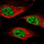 Immunofluorescent staining of human cell line U-2 OS shows localization to nuclear speckles.