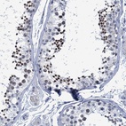 Anti-C16orf95 Antibody