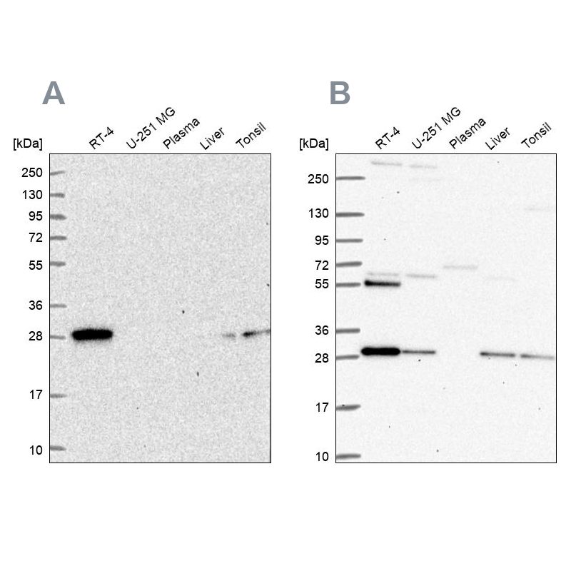 Anti-PMM2 Antibody
