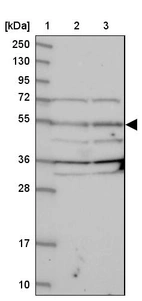 Lane 1: Marker [kDa] 250, 130, 95, 72, 55, 36, 28, 17, 10_br/_Lane 2: Human cell line RT-4_br/_Lane 3: Human cell line U-251MG sp