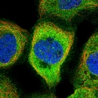 Immunofluorescent staining of human cell line A-431 shows localization to plasma membrane & cytosol.