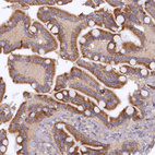 Anti-ARL11 Antibody