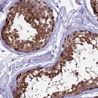 Immunohistochemical staining of human testis shows strong cytoplasmic positivity in cells in seminiferous ducts.
