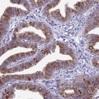 Immunohistochemical staining of human fallopian tube shows moderate cytoplasmic positivity in glandular cells.